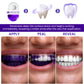 Limited sale💖Buy 1 get 1 free🎉  Purple Teeth Whitening Strips⚡The 30-Minute White Rescue