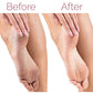⚡ LAST CHANCE: 50% OFF! 🔥Electric Foot Callus Remover – Smooth Feet in Seconds! 🦶✨