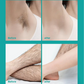 🌟2026 New-🔥Painless Full Body Hair Removal Cream for Men & Women– Skin-friendly for all areas🌿
